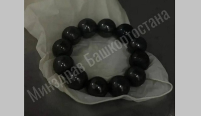 В Башкортостане спасли 10-летнюю девочку, проглотившую 12 магнитных шариков